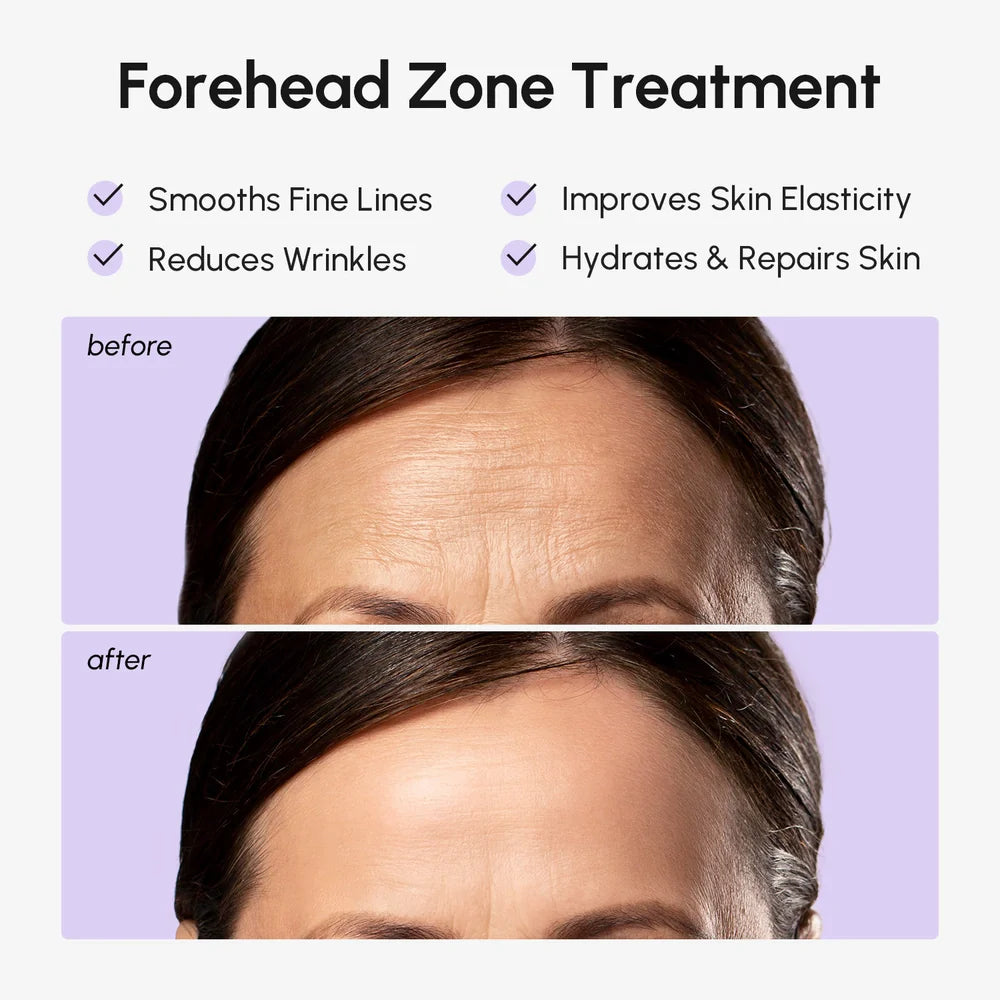 Marée Anti-Wrinkle Forehead Patches – Hydrogel Smoothing & Lifting Patches